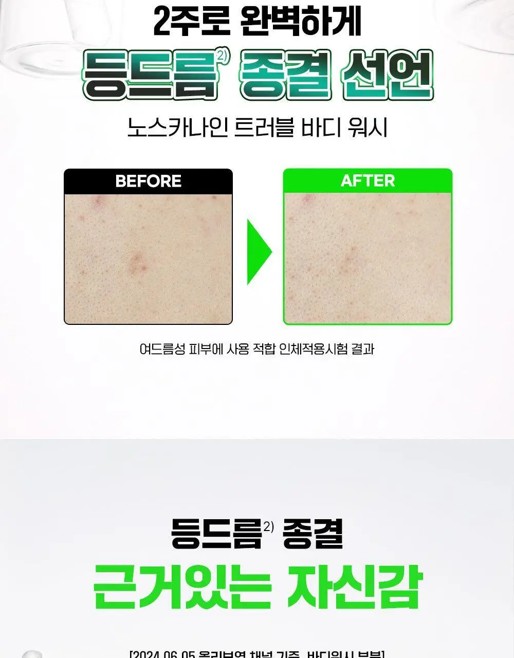 [1위등드름워시/단독기획] 파티온 노스카나인 트러블 바디워시 490ml 기획 상세페이지 4